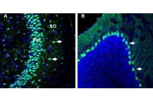 Expression of Kidins220 in mouse hippocampus and cerebellum - Immunohistochemical staining of perfusion-fixed frozen mouse brain sections with Anti-Kidins220 Antibody (ABIN7043293, ABIN7045160 and ABIN7045161), (1:1000), followed by goat-anti-rabbit-AlexaFluor-488. (KIDINS220 Antikörper  (Intracellular))