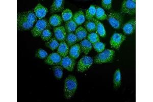 IF analysis of PINK1 using anti-PINK1 antibody (ABIN7599749).