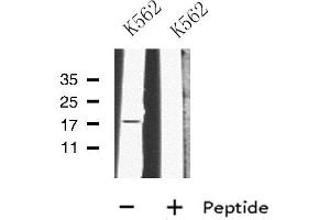 Western blot analysis of MRPL23 using K562 whole cell lysates