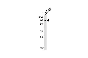 Western blot analysis of lysate from LNCap cell line, using CYP51A1 Antibody at 1:1000 at each lane. (CYP51A1 Antikörper  (AA 250-279))