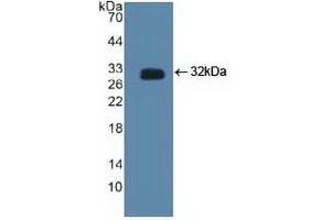 Detection of Recombinant CTBP2, Human using Polyclonal Antibody to C-Terminal Binding Protein 2 (CTBP2) (CTBP2 Antikörper  (AA 1-252))