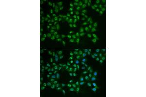 Immunofluorescence (IF) image for anti-Bruton Agammaglobulinemia tyrosine Kinase (BTK) (AA 30-240) antibody (ABIN6218643) (BTK Antikörper  (AA 30-240))