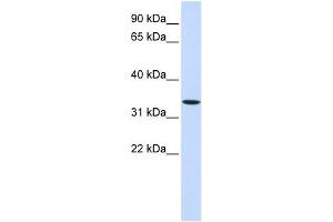 Western Blotting (WB) image for anti-Wingless-Type MMTV Integration Site Family, Member 6 (WNT6) (Middle Region) antibody (ABIN635755)