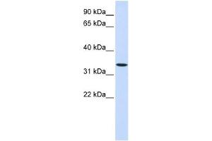 WNT6 antibody used at 1 ug/ml to detect target protein. (WNT6 Antikörper  (Middle Region))