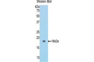 Western blot analysis of the recombinant protein. (MGEA5 Antikörper  (AA 83-222))