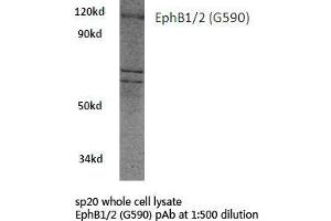 Western blot (WB) analysis of EphB1/2 antibody in extracts from sp20 cells. (EPH Receptor B1 Antikörper)