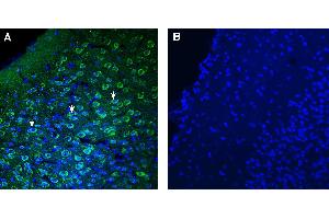 Expression of TMEM175 in mouse piriform cortex. (TMEM175 Antikörper  (AA 278-291))