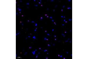 Immunofluorescent analysis of paraffin embedded mouse brain using KCNIP3 (ABIN7073771) at dilution of 1: 1000 (DREAM Antikörper)