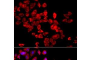 Immunofluorescence analysis of A549 cells using EIF4G1 Polyclonal Antibody (EIF4G1 Antikörper)