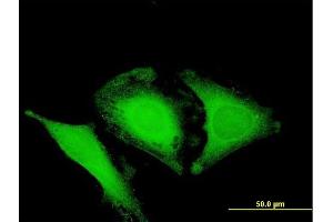 Immunofluorescence of purified MaxPab antibody to OPTN on HeLa cell. (OPTN Antikörper  (AA 1-577))