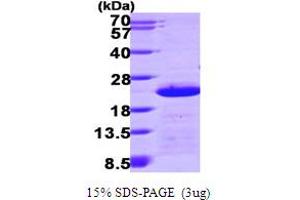 SDS-PAGE (SDS) image for Centrin, EF-Hand Protein, 2 (CETN2) (AA 1-172) protein (His tag) (ABIN667312)
