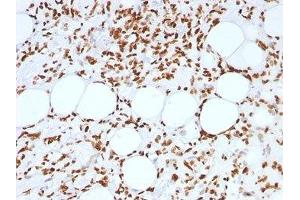 FFPE human angiosarcoma tested with Histone antibody (AE-4)