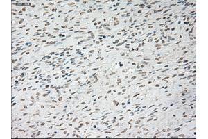 Immunohistochemical staining of paraffin-embedded Ovary tissue using anti-TNNI3mouse monoclonal antibody. (TNNI3 Antikörper  (AA 1-210))