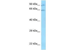 WB Suggested Anti-ZNF280B Antibody   Titration: 1. (ZNF280B Antikörper  (N-Term))