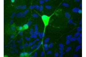 Shows rat mixed neuron/glial cultures stained with UCHL1 polyclonal antibody  (green). (UCHL1 Antikörper)