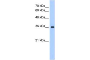 Western Blotting (WB) image for anti-ELOVL Fatty Acid Elongase 7 (ELOVL7) antibody (ABIN2463300) (ELOVL7 Antikörper)