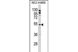 Western blot analysis of BLNK Antibody (Center) (ABIN390395 and ABIN2840787) in NCI- cell line lysates (35 μg/lane). (B-Cell Linker Antikörper  (AA 150-178))