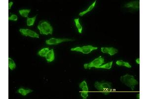 Immunofluorescence of monoclonal antibody to ACP2 on HeLa cell. (ACP2 Antikörper  (AA 1-423))