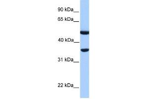 DNAJB6 antibody used at 1 ug/ml to detect target protein. (DNAJB6 Antikörper)