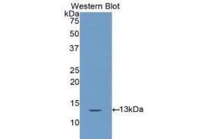 Western Blotting (WB) image for anti-Cystatin A (Stefin A) (CSTA) (AA 1-98) antibody (ABIN1172941) (CSTA Antikörper  (AA 1-98))
