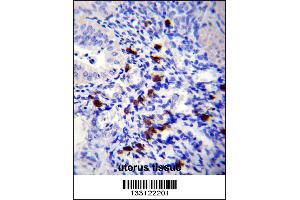 TNN Antibody immunohistochemistry analysis in formalin fixed and paraffin embedded human uterus tissue followed by peroxidase conjugation of the secondary antibody and DAB staining. (Tenascin N Antikörper  (AA 587-615))