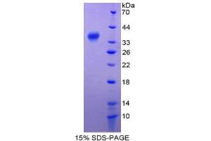 SDS-PAGE (SDS) image for Nuclear Factor-kB p65 (NFkBP65) (AA 19-306) protein (His tag) (ABIN2127188) (NF-kB p65 Protein (AA 19-306) (His tag))