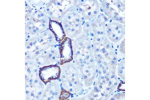 Immunohistochemistry (IHC) image for anti-TBCC Domain Containing 1 (TBCCD1) antibody (ABIN7270751)