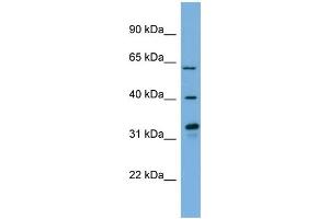 WB Suggested Anti-FMO3  Antibody Titration: 0. (FMO3 Antikörper  (N-Term))