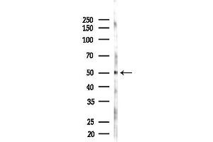 anti-LUC7-Like 3 (LUC7L3) (C-Term) antibody