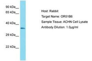 Image no. 1 for anti-Olfactory Receptor, Family 51, Subfamily B, Member 6 (OR51B6) (AA 200-249) antibody (ABIN6750809) (OR51B6 Antikörper  (AA 200-249))