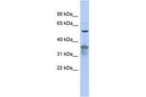 Image no. 1 for anti-RAB3A Interacting Protein (Rabin3) (RAB3IP) (AA 35-84) antibody (ABIN6743738) (RAB3IP Antikörper  (AA 35-84))