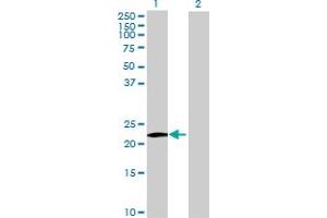 Western Blot analysis of MS4A8B expression in transfected 293T cell line by MS4A8B MaxPab polyclonal antibody. (Membrane-Spanning 4-Domains, Subfamily A, Member 8 (MS4A8) (AA 1-250) Antikörper)