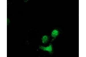 Anti-DSTN mouse monoclonal antibody (ABIN2454365) immunofluorescent staining of COS7 cells transiently transfected by pCMV6-ENTRY DSTN (RC203419).