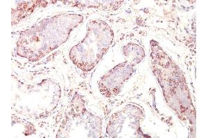 Formalin-fixed, paraffin-embedded human Testicular Carcinoma stained with MAGE-1 Monoclonal Antibody (MZ2E/838). (MAGEA1 Antikörper)