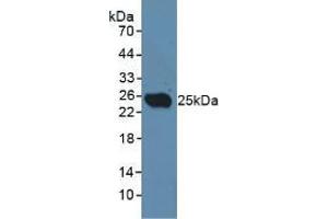 Western blot analysis of Rat Testis Tissue. (CLEC10A Antikörper  (AA 71-239))