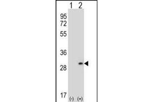 Western blot analysis of DPT (arrow) using rabbit polyclonal DPT Antibody (N-term) (ABIN656571 and ABIN2845833). (Dermatopontin Antikörper  (N-Term))