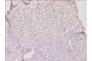 Immunohistochemistry of paraffin-embedded human tonsil tissue using ABIN7155585 at dilution of 1:50 (HLA-DPB1 Antikörper  (AA 30-225))
