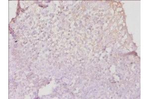 Immunohistochemistry of paraffin-embedded human tonsil tissue using ABIN7155585 at dilution of 1:50