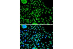 Immunofluorescence analysis of MCF-7 cells using ATOH7 antibody (ABIN5974375).