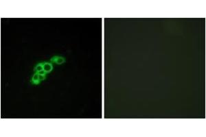 Immunofluorescence analysis of MCF7 cells, using FSHR Antibody. (FSHR Antikörper  (AA 278-327))