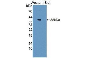 Western blot analysis of the recombinant protein. (GTF3A Antikörper  (AA 71-365))