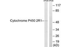 Western blot analysis of extracts from HT29 cells, using Cytochrome P450 2R1 Antibody. (CYP2R1 Antikörper  (AA 251-300))