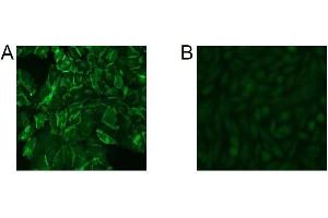Immunofluorescence Microscopy of CHO cells using D14HD11. (CD66acde Antikörper)