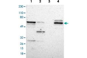 Western blot analysis of Lane 1: RT-4, Lane 2: U-251MG sp, Lane 3: Human plasma (IgG/HSA depleted), Lane 4: Human with DPYSL2 polyclonal antibody  at 1:250-1:500 dilution. (DPYSL2 Antikörper)