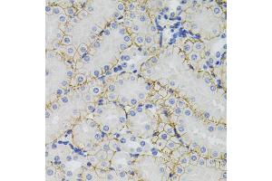 Immunohistochemistry of paraffin-embedded mouse kidney using SLC1A4 antibody (ABIN5971578) (40x lens).