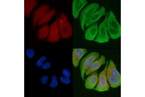 ABIN6258488 and ABIN6274479 staining Hela cells(45 min of heat-shock) by IF/ICC. (IP6K3 Antikörper  (Internal Region))
