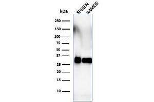 Western Blot Analysis of Ramos cells and human spleen tissue lysate using HLA-DRB Monoclonal Antibody (SPM288).
