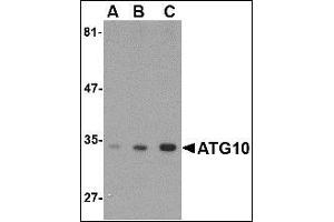AP20062PU-N ATG10 antibody staining of SK-N-SH Cell Lysate by Western Blotting at (A) 0. (ATG10 Antikörper  (C-Term))