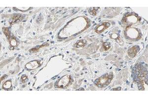 ABIN6277492 at 1/100 staining Human prostate tissue by IHC-P. (RRM2 Antikörper  (C-Term))