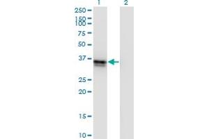 Western Blot analysis of FRZB expression in transfected 293T cell line by FRZB monoclonal antibody (M01), clone 4F7. (FRZB Antikörper  (AA 102-190))
